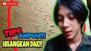 Cara menghilangkan panudengan bahan alami sangat penting diketahui untuk mengatasi dan mengobati masalah panu. Cara Menghilangkan Daki Dengan Pelembab Cara Cute766