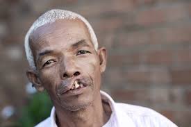 Alfred's Story of Love, Integrity and a New Smile