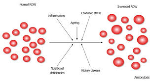 Red Blood Cell Distribution Width In Heart Failure A