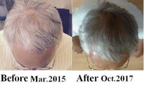 I tried the yao women rice water recipe for hair growth and my natural hair felt great afterwards! Testimonials Active Hydrogen Mineral Water