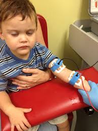 Image result for Sweat Chloride