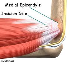 The tendon of the subscapularis muscle attaches both to the lesser tubercle aswell as to the greater tubercle giving support to the long head of the biceps in. Golfer S Elbow Treatment Richmond Va Elbow Pain Treatment Henrico County Chesterfield County