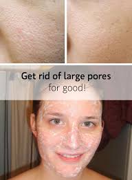 Large Pores Myths Busted Tested Treatments Face Pores Best Pore Minimizer Skin Care Secrets