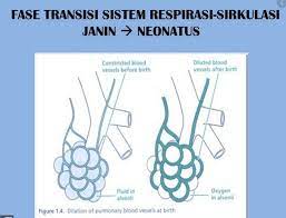 Membran pleura dan otot respirasi yang membentuk diafragma dan otot interkosta juga merupakan bagian dari sistem respirasi. Adaptasi Bayi Baru Lahir