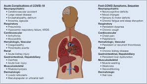Most of these patients are being. A Clinic Blueprint For Post Coronavirus Disease 2019 Recovery Chest