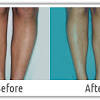 Discover laser hair removal deals in and near saint louis, mo and save up to 70% off. 1