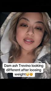 Neurofibrosis Ashley Transformation