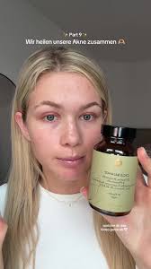 Natürlich Akne behandeln: Tipps und Supplements