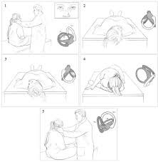 Image result for Canalith Repositioning Procedure