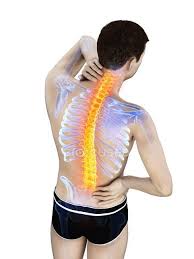 We did not find results for: Male Silhouette With Back Pain On White Background Conceptual Illustration Vertebra Bones Stock Photo 308615514