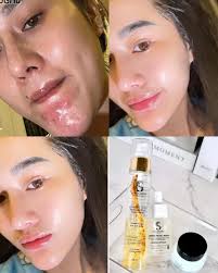 Bee Ly -ប៊ីលី