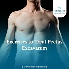 Image result for Pectus Excavatum
