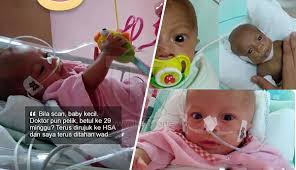 Betul Ke 29 Minggu Saya Terus Ditahan Wad Ibu Lahir Bayi Besar Tapak Tangan 800 Gram Selalu Orang Nasihatkan Bila Mengandung J Children Baby Face Baby
