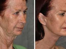 Lily Estep's Instagram, Twitter & Facebook