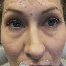 Lips transformed and liberated!