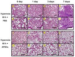 In comparison to this, the lungs of ruminants and pigs are obviously lobed. A B C D Lung Histology H E Staining 200x Magnification Of Mice Download Scientific Diagram