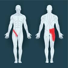 The fascia lata is the deep fascia of the thigh and encloses the muscles and forms the outer limit of the fascial compartments. Common Groin Injuries My Family Physio