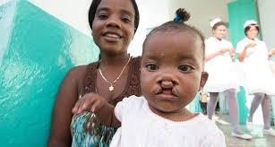 July is National Cleft and Craniofacial Awareness and Prevention Month 💙  To mark this important occasion, we're spotlighting a bonus-sized  Pediatric/Craniofacial section—personally curated by our  Pediatric/Craniofacial Section Editor, Dr. Larry ...