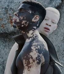 Models Unique Faces Vitiligo Model Black Male Models
