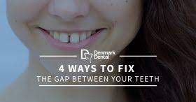 Gap teeth can create pockets between your teeth and gums where food can get stuck. 4 Ways To Fix The Gap In Your Teeth Denmark Dental
