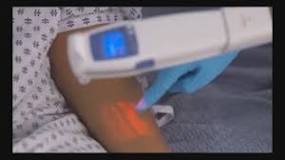 Vein finder gadget eases blood draws, IVs | king5.com