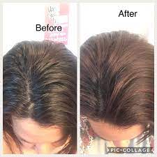 You can consider dry shampoo to be more of a hair freshener than a hair cleaner. Before And After Use Of The Champ Conditioning Dry Shampoo By Monat Game Changer Monat Dry Shampoo Dry Shampoo Monat Before And After