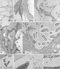 Image result for pseudomonas savastanoi pv nerii oleander symptoms