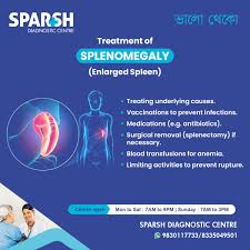 Image result for Splenomegaly