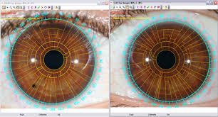 Cosmiciris Multidimensional Iridology Software