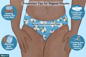 Ingrown hair removed from pubic area, so painful! Vaginal Pimples Why They Form And What To Do