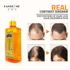 Mix two or three eggs in a bowl, and once you've washed your hair with a quality shampoo, cover your hair from root to tip with the mixture. Buy 300ml Ginger Shampoo Anti Hair Baldness Anti Hair Loss Dandruff Black Hair Shampoo Professional Grow Thick Hair Growth Products Online In Lebanon 32885047885