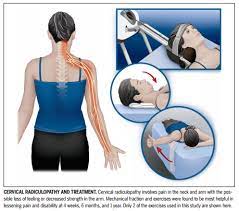 Check spelling or type a new query. 12 Cervical Radiculopathy Ideas Radiculopathy Cervical Radiculopathy Cervical