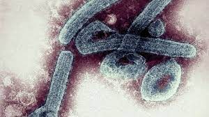 Ebola is a rare but deadly virus that causes fever, body aches, and diarrhea, and sometimes bleeding inside and outside the body. Ozxr7hmsrxr9hm