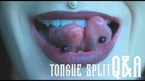 Q A Tongue Split Experience Youtube