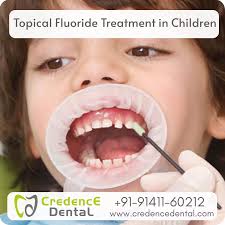 Image result for Topical Fluoride