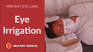 Image result for Eye Irrigation
