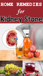Home Remedies For Kidney Stone Home Remedies For Kidney Stone In 2020 Kidney Stones Remedy Kidney Stones Kidney Stones Recipes