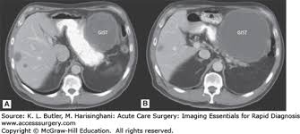 Image result for Succussion Splash