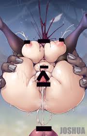 Uterine Prolapse Porn - Page 3 Of 5 - Rule 34