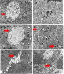 The structure and function of liver cells. Electron Microscope Images Of Rat Liver Cell Changes Control Group Download Scientific Diagram