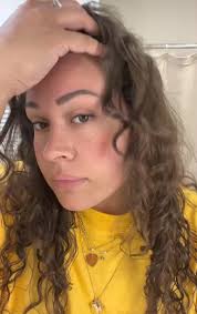 🚨Attention to anyone with a dry scalp!!! You may or may not have heard,  but we've been working