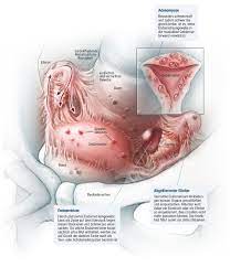 Nach innen folgt eine dicke schicht aus muskelzellen, myometrium genannt. Endometriose Ist Eine Der Unterschatzten Frauenkrankheiten Spektrum Der Wissenschaft