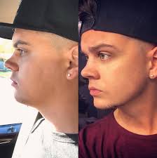 Celebrities' Weight Loss and Transformations: Before and After