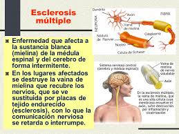 Calabresi pa, multiple sclerosis and demyelinating conditions of the central nervous system. Inmunopatologia De La Hipersensibilidad Tipo Iv Ppt Video Online Descargar