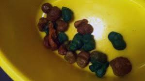 Some underlying medical problems, such as gallbladder and liver disease, can also change stool color. Causes Of Blue Stools In Young Kids Adults Reassurance Scary Symptoms