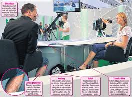 Image result for robert zaruba vitiligo