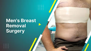 Men's Breast Removal Surgery | Liposuction For Man Boobs 2023