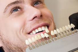 Mckinney Cosmetic Dentist Porcelain Veneers Teeth Whitening