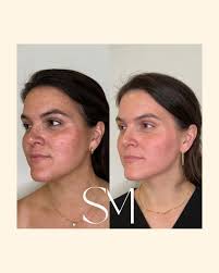 Jenny Warren (@jenny_warren_aesthetics) • Instagram photos and videos