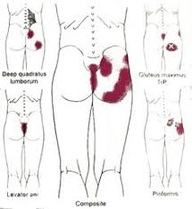 Self Myofascial Release For Chronic Pelvic Floor Pains Ajimshaw S Approach Part Ii Specific Sessions I Ext Pelvic Floor Dysfunction Pelvic Girdle Pelvic Floor